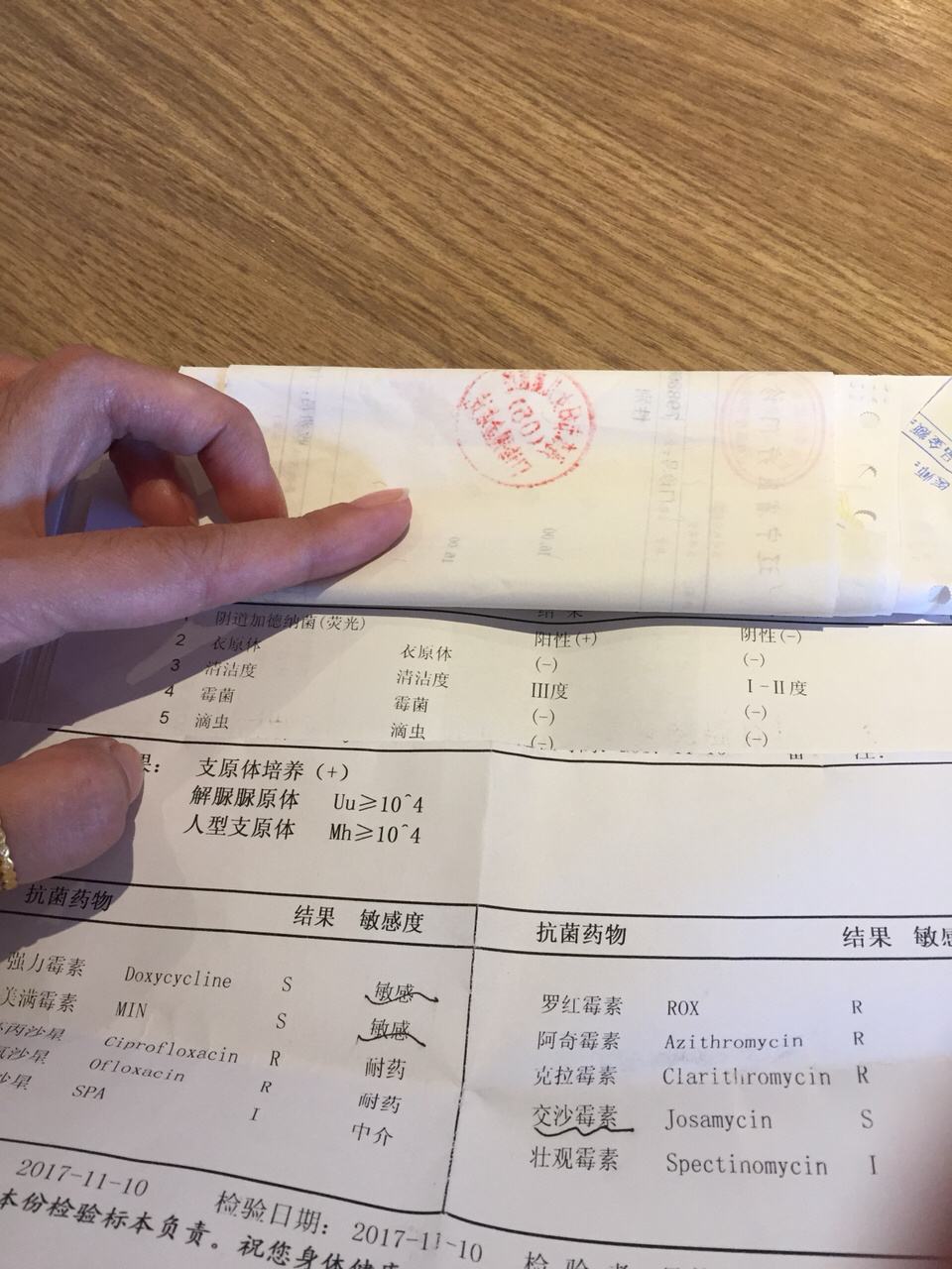 为什么会有支原体 为什么会有支原体感染妇科