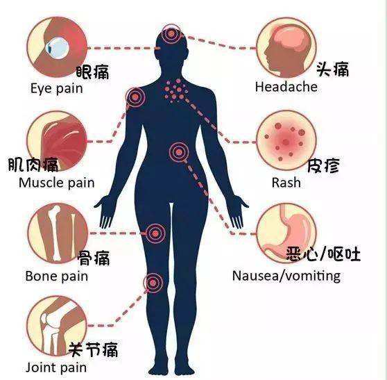 为什么烧一直不退 高烧为什么一直不退