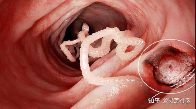 牛肉绦虫减肥 牛肉绦虫减肥可以吃吗