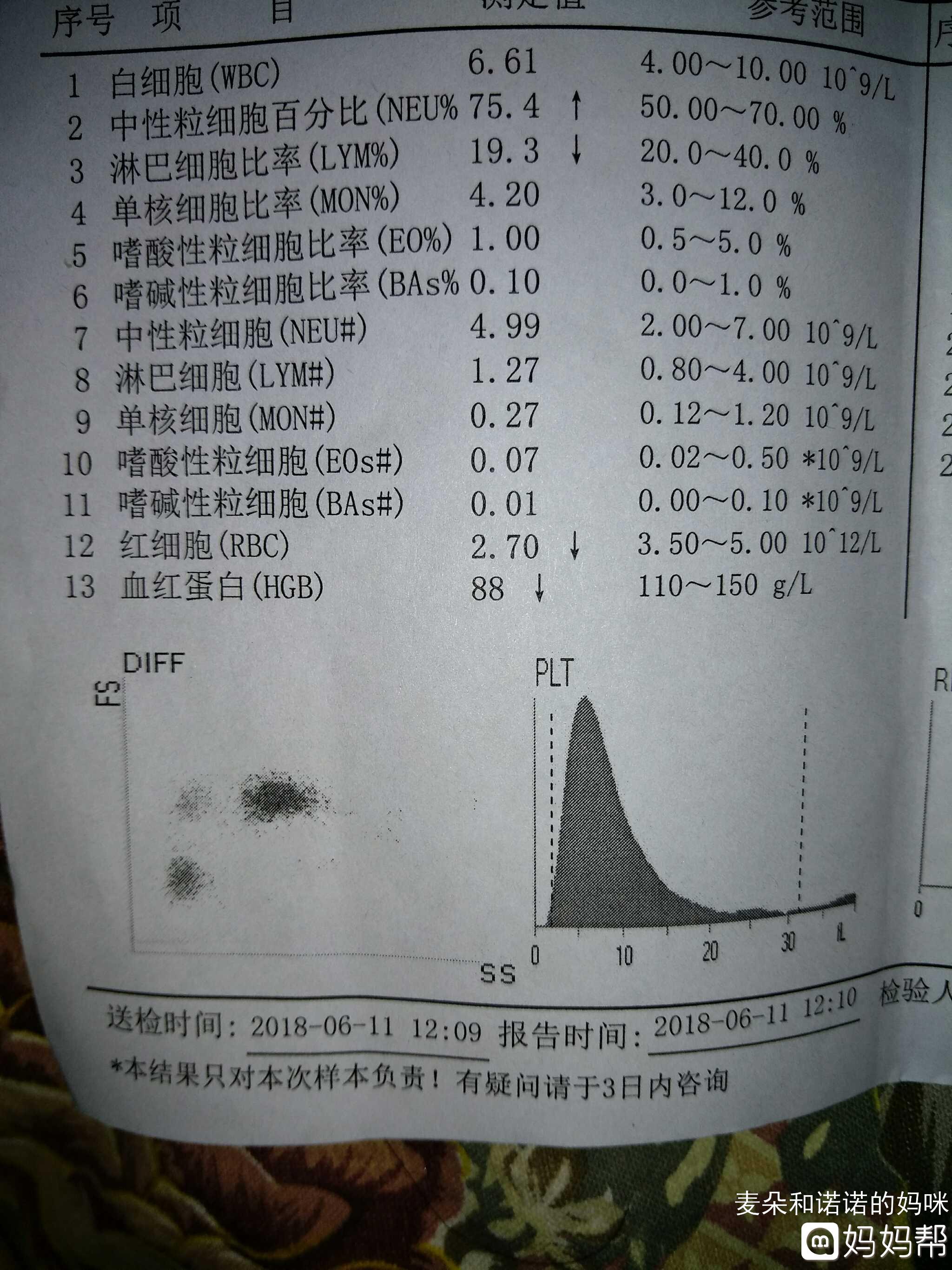 小孩中度贫血怎么办 儿童中度贫血怎么治疗