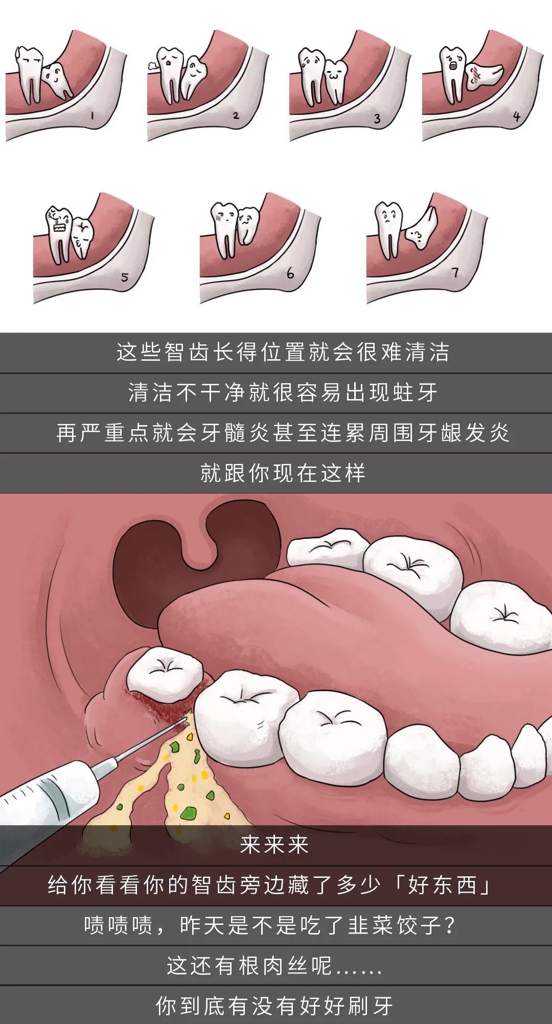 拔了智齿发炎肿痛怎么办 智齿发炎肿痛拔牙了会怎样