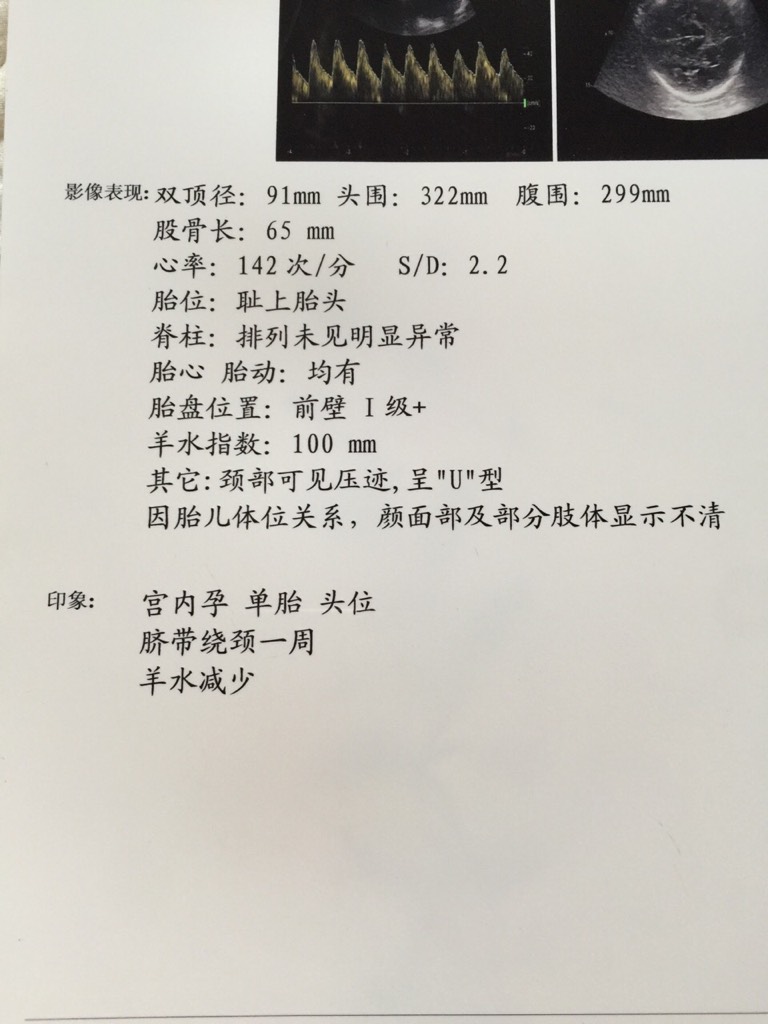 孕38周股骨长67怎么办 38周宝宝股骨长只有67怎么办