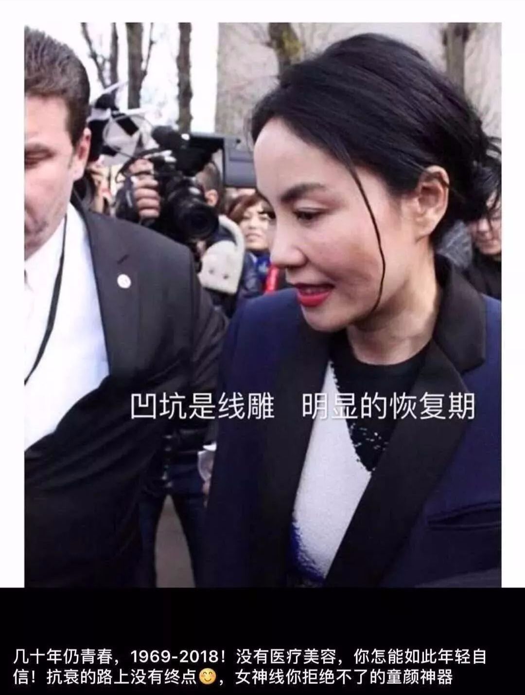 打完玻尿酸多久可以做线雕 打完玻尿酸多久可以做线雕提升